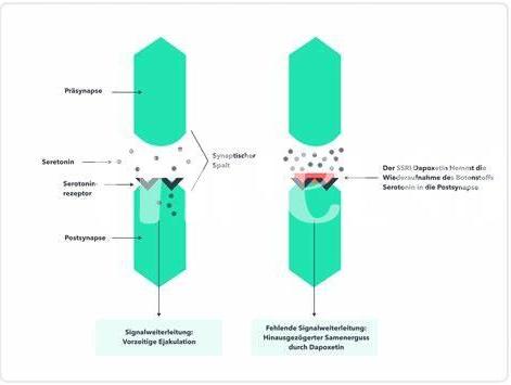 Dapoxetin: Häufige Fragen Und Antworten